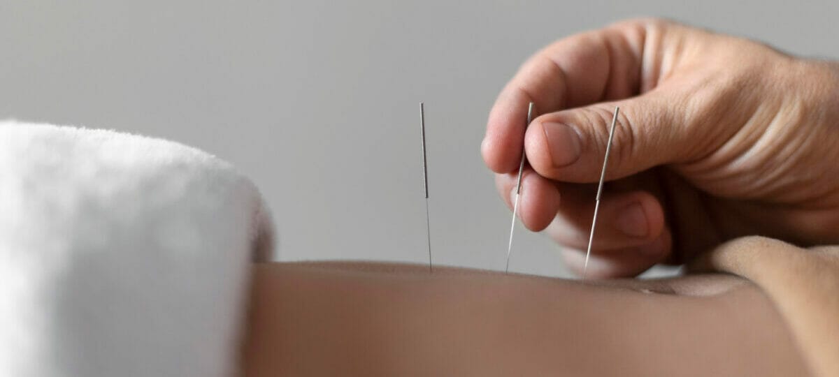 Tehnici Avansate în Acupunctură: Echilibrul Energetic și Vindecarea
